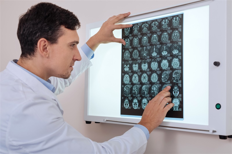 矢状窦脑膜瘤手术治疗分析